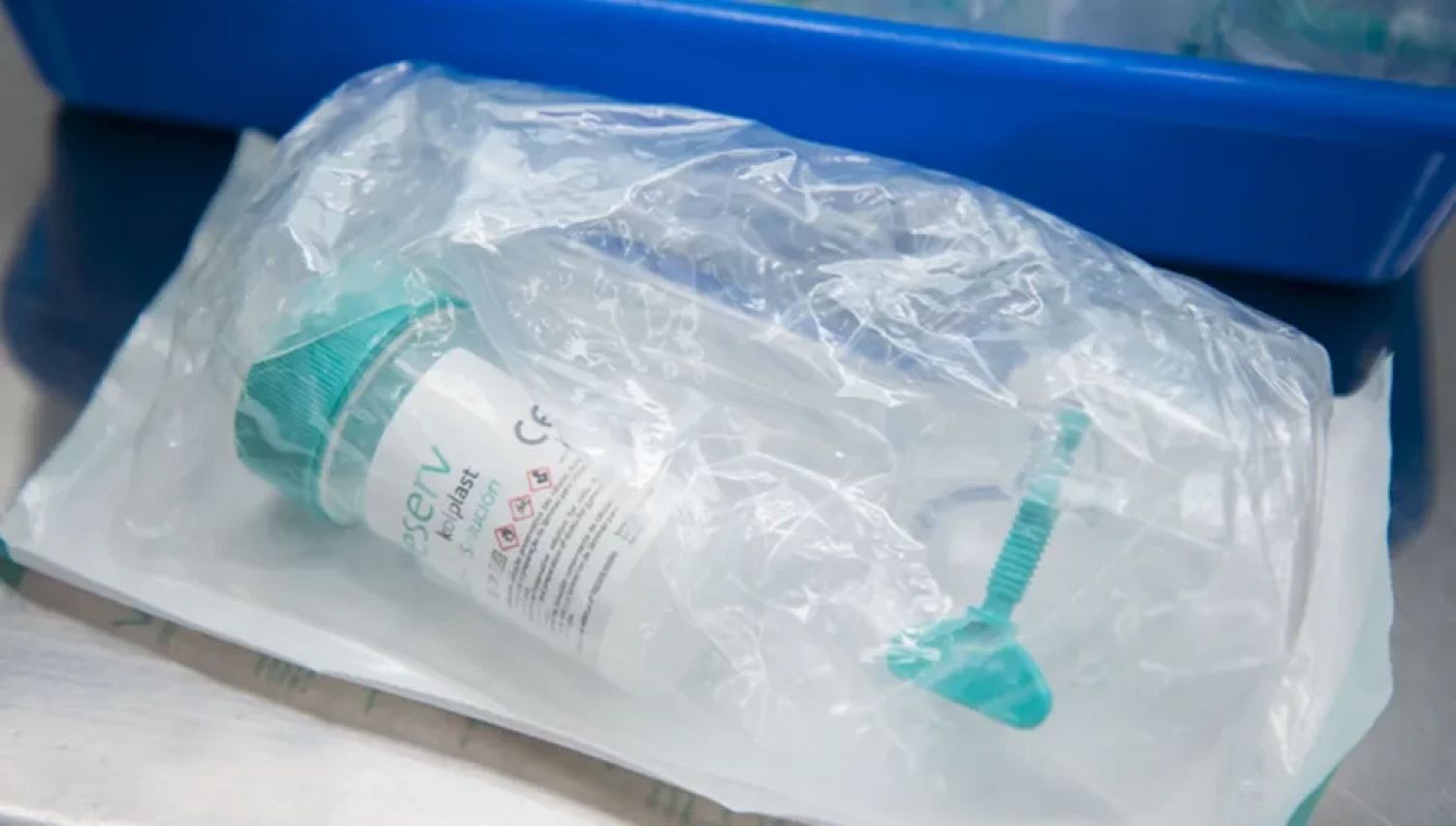 Novo teste de HPV no SUS promete revolucionar prevenção do câncer do colo do útero