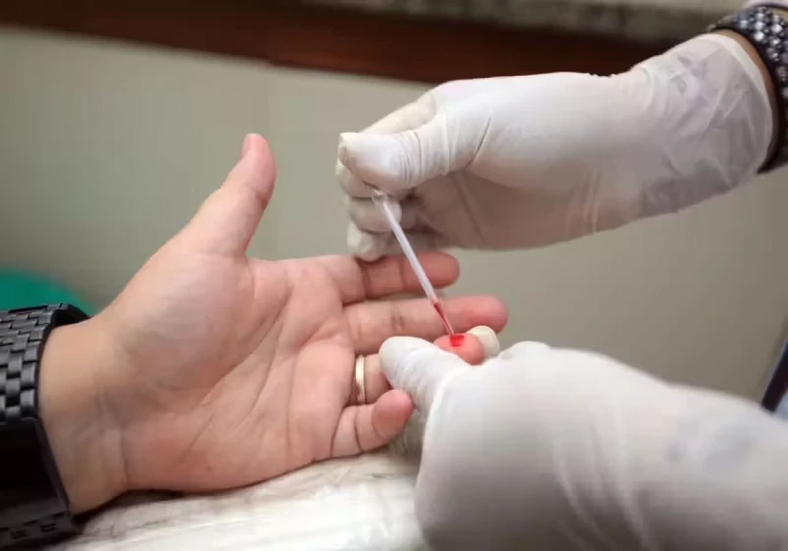 HIV cria refúgio no intestino e desafia ação de remédios, aponta pesquisa
