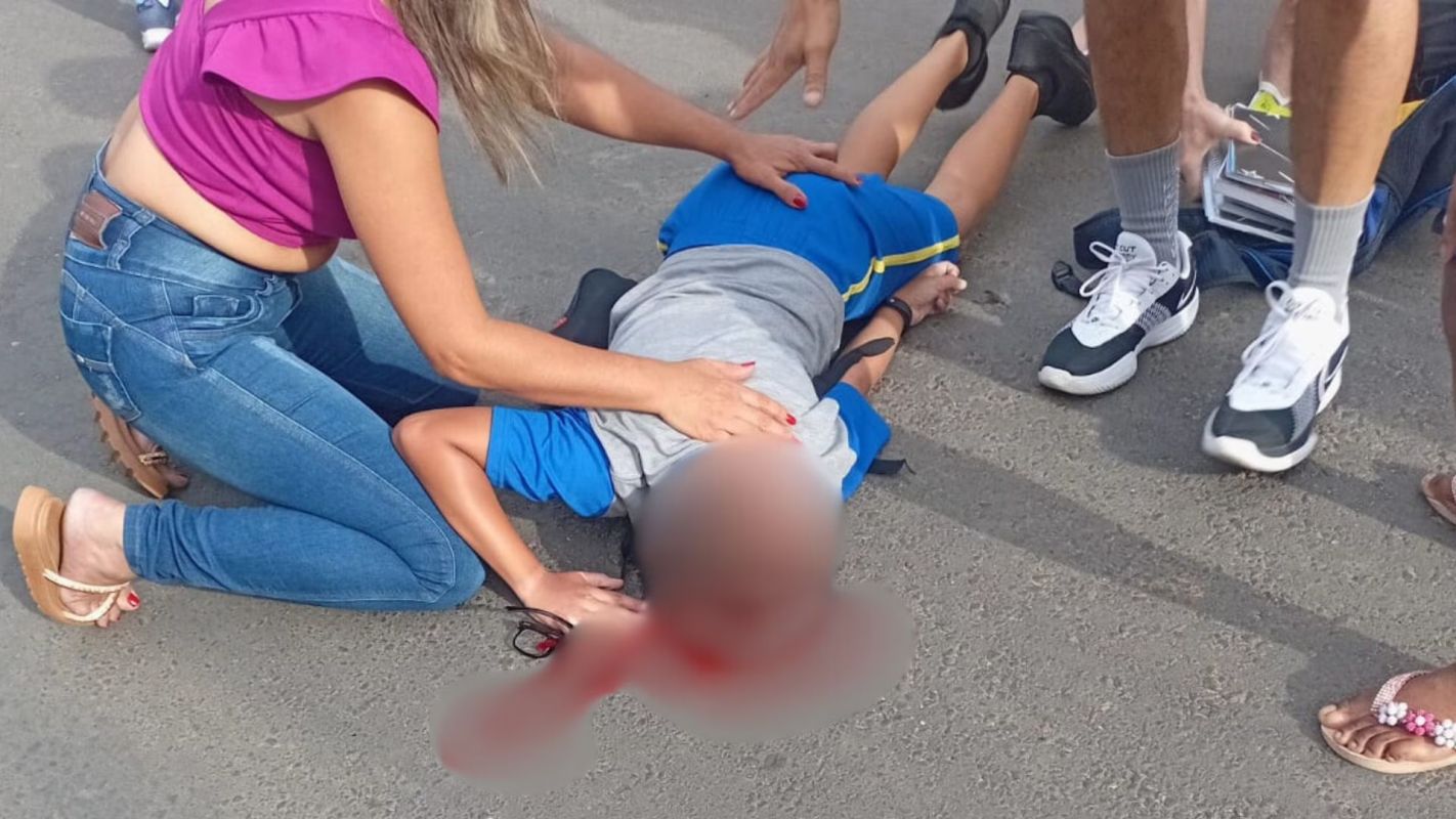 Criança cai de bicicleta e fratura a cabeça enquanto ia para a escola em Fabriciano; família suspeita de atropelamento