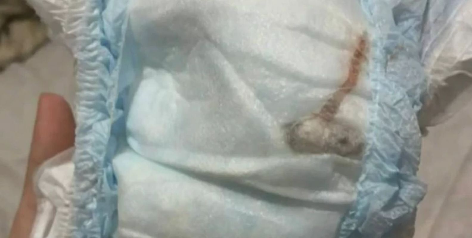  Análise descarta rato e revela plástico em fralda de bebê