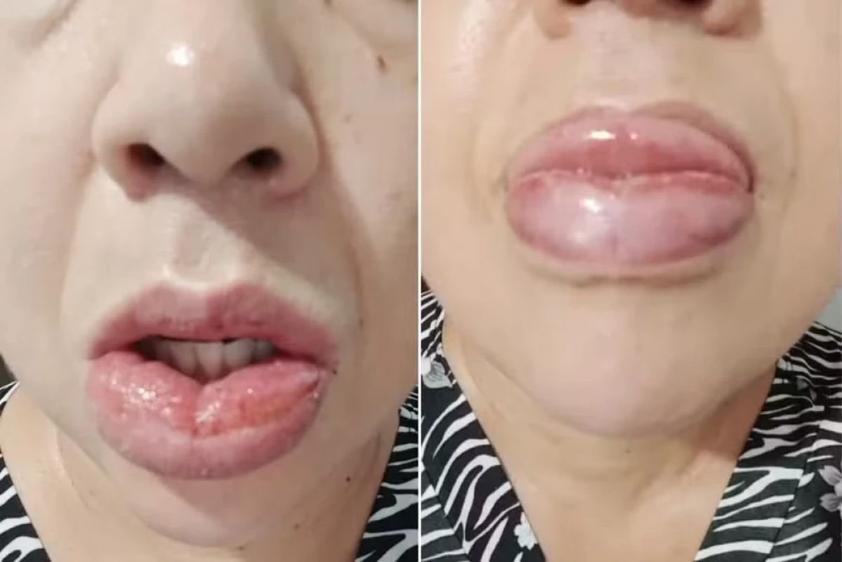 Colgate retira de linha versão Clean Mint após centenas de queixas à Anvisa