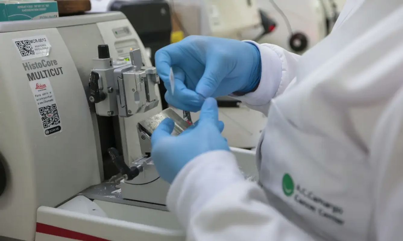 SUS incorpora venetoclax e azacitidina para adultos com leucemia mieloide aguda