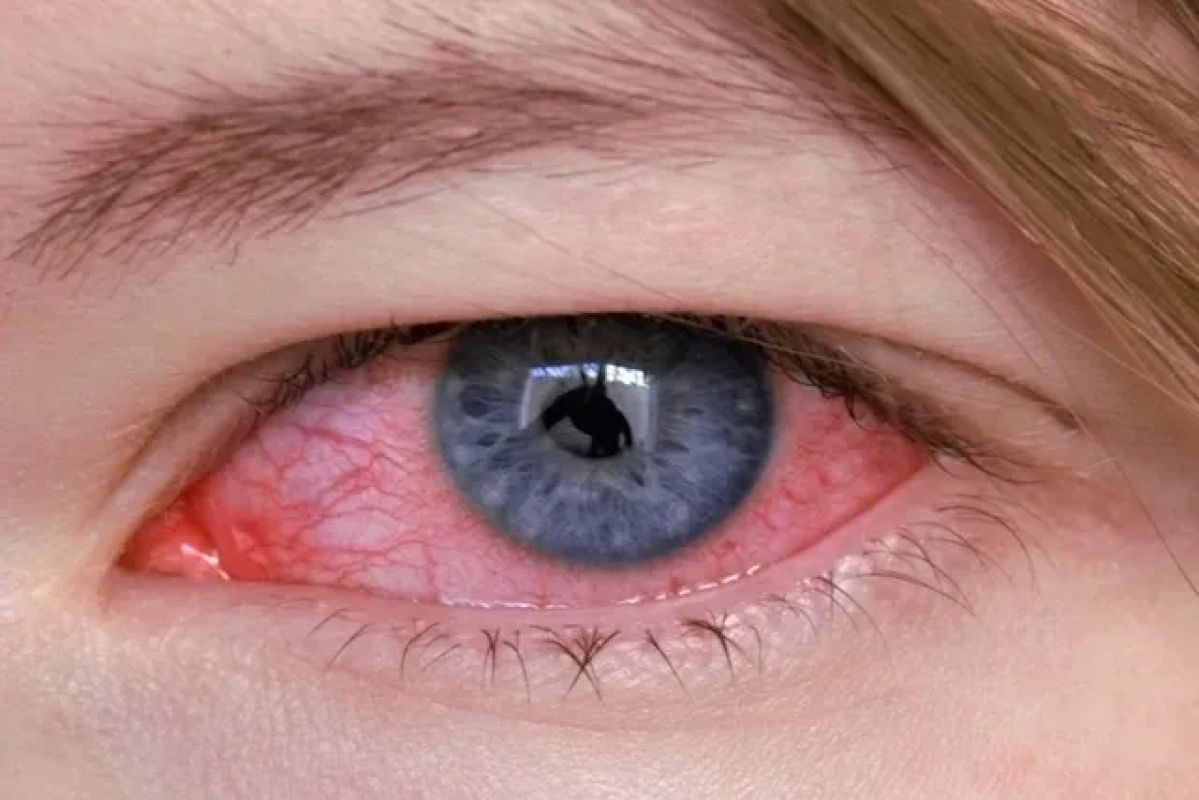 Funcionária é demitida por usar foto da internet em consulta médica online