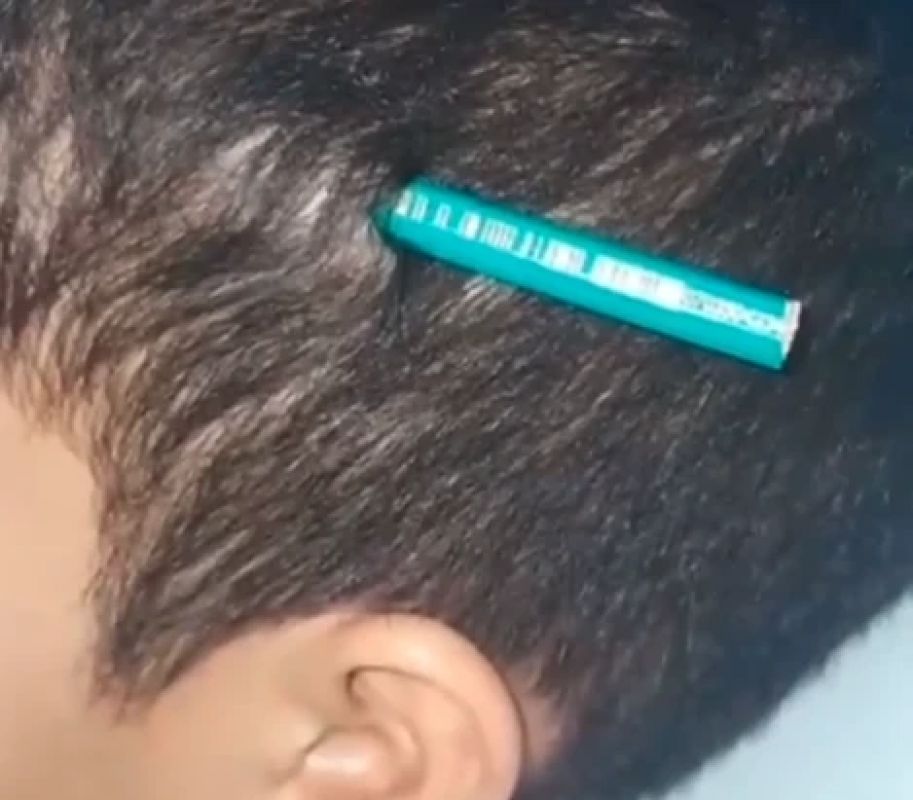 Aluno crava lápis na cabeça de colega durante briga em escola no litoral de SP
