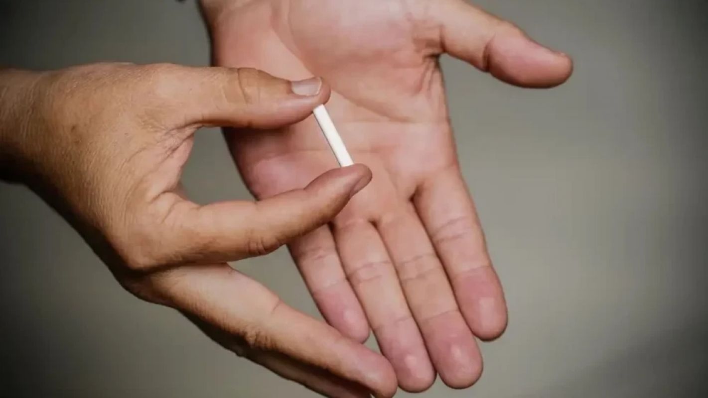 Planos de saúde passam a cobrir implante contraceptivo a partir de setembro