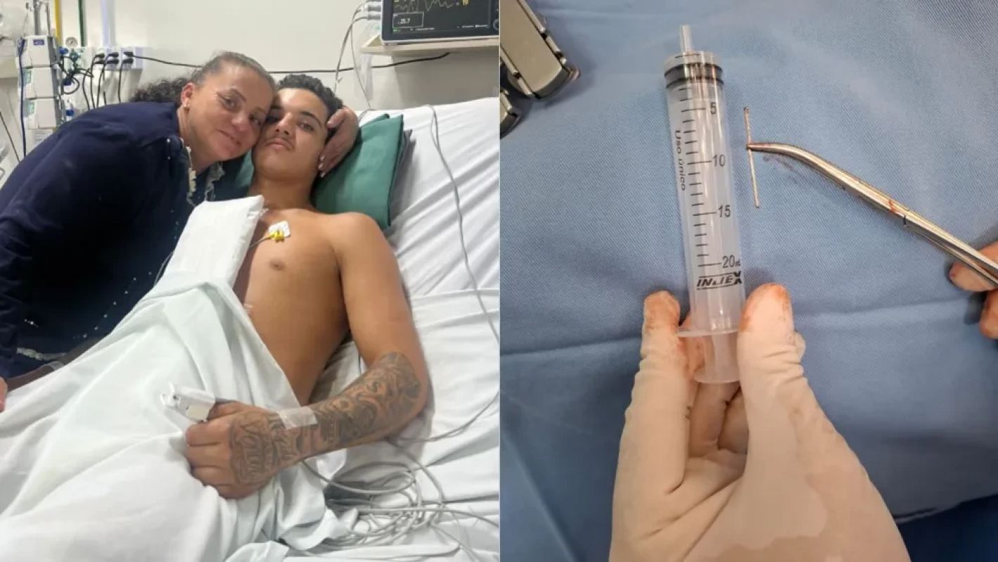 Adolescente sobrevive após prego atingir o coração em acidente com ferramenta