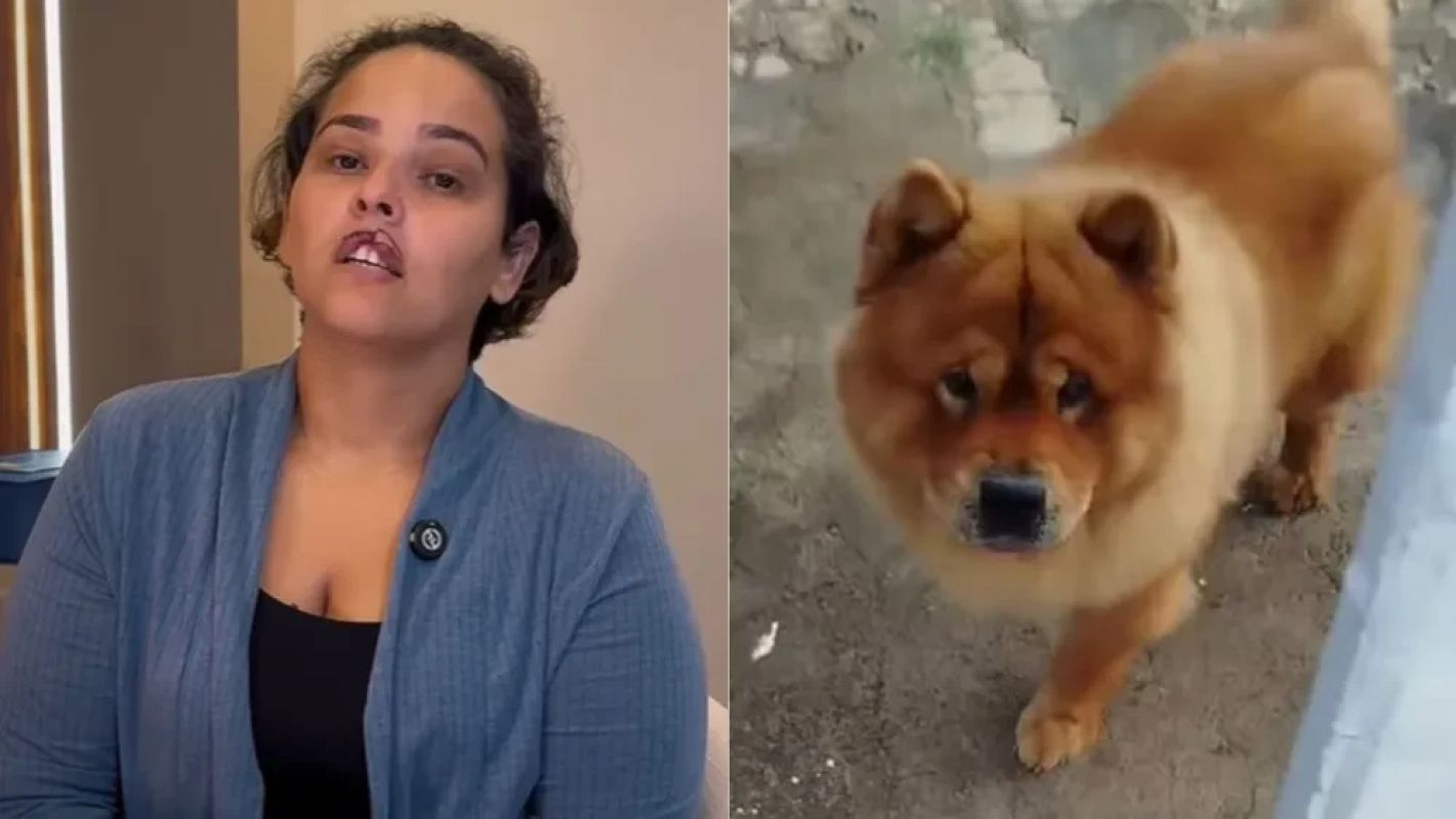 Mulher tem lábio arrancado por cachorro e passa por cirurgia gratuita de reconstrução