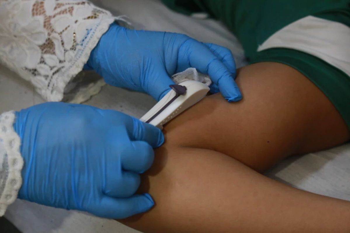 Fortaleza inicia distribuição de anticoncepcional para adolescentes a partir dos 10 anos
