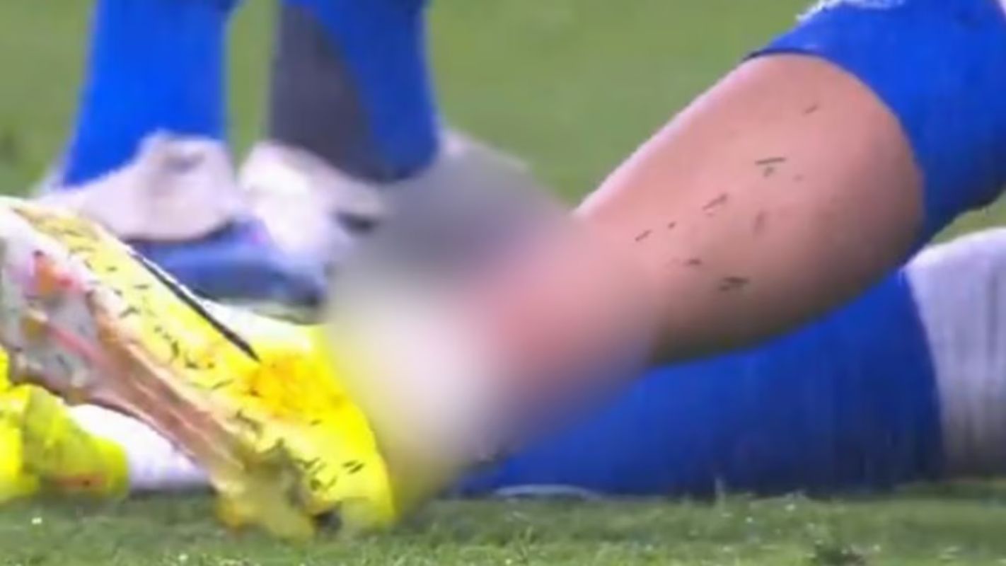 Gabriel Pec fratura a tíbia na estreia pelo Cruzeiro e passará por cirurgia