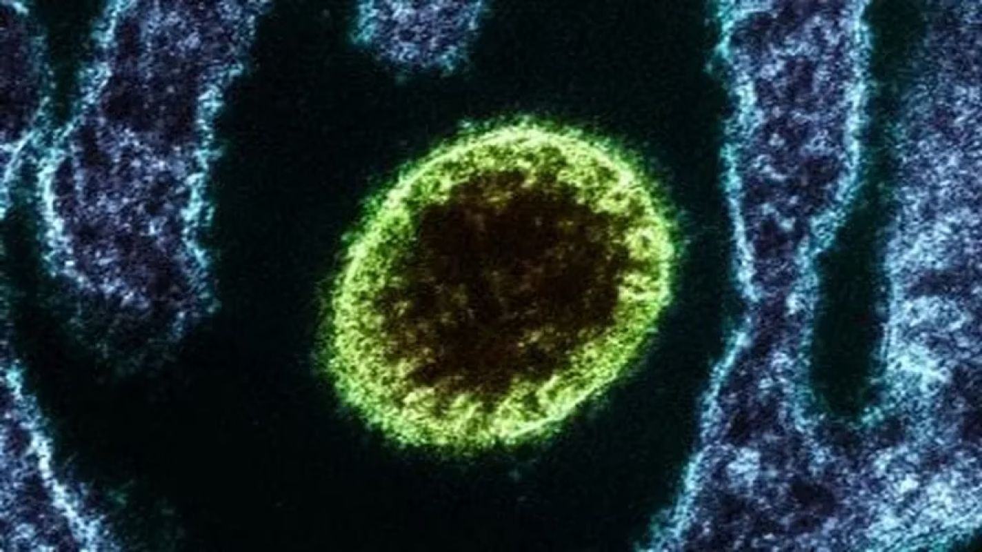 Casos de vírus Nipah na Índia elevam vigilância, mas OMS descarta risco global alto
