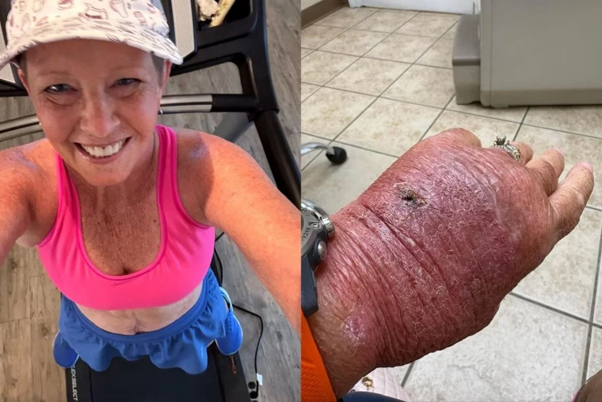 Corte com papelão infecciona e leva mulher ao hospital; foto viraliza
