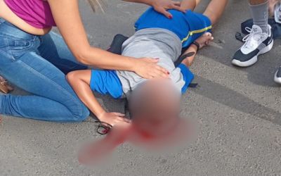 Criança cai de bicicleta e fratura a cabeça enquanto ia para a escola em Fabriciano; família suspeita de atropelamento