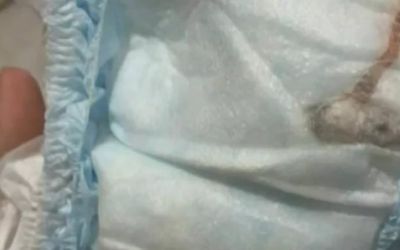  Análise descarta rato e revela plástico em fralda de bebê