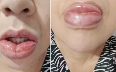 Colgate retira de linha versão Clean Mint após centenas de queixas à Anvisa