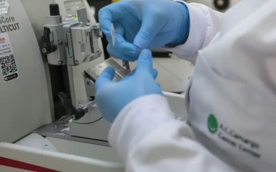 SUS incorpora venetoclax e azacitidina para adultos com leucemia mieloide aguda