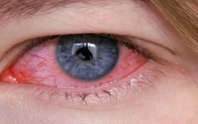 Funcionária é demitida por usar foto da internet em consulta médica online