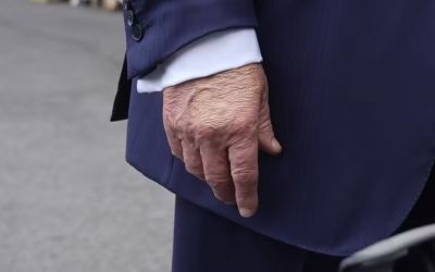 Trump é diagnosticado com insuficiência venosa crônica, diz Casa Branca