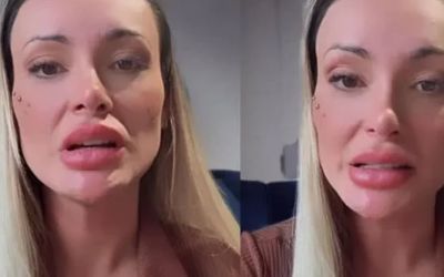Saúde mental: Andressa Urach enfrenta grave crise e revela transtorno em desabafo