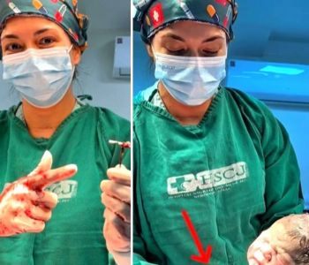 Recém-nascido surpreende ao vir ao mundo com DIU na mão após falha de contraceptivo