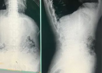  Cinco presos são flagrados com drogas no estômago ao retornar de 'saidinha' em MG