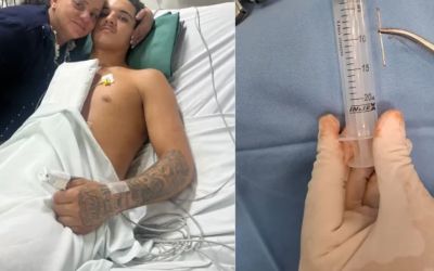 Adolescente sobrevive após prego atingir o coração em acidente com ferramenta