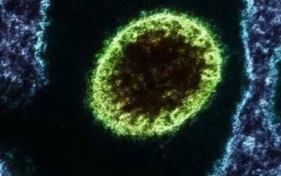Casos de vírus Nipah na Índia elevam vigilância, mas OMS descarta risco global alto